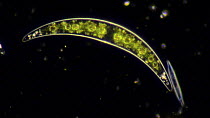 Diatom (Closterium) with spherical chloroplasts (green pigmentation) and mineral granules at tips moving through Brownian motion. Other diatoms are visible.