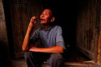 An old man sitting in front of his house with arm deformed by Hundred-pace pitviper snake bite (Deinagkistrodon acutus) Fanjingshan National Nature Reserve, Guizhou Province, China, June 2008.