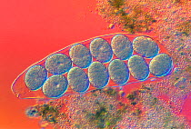 Tardigrade (Hypsibius dujardini) cuticle containing eggs.