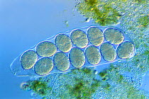 Tardigrade (Hypsibius dujardini) cuticle containing eggs.