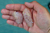 Egg sacs of a female lionfish (Pterois volitans). Females can produce two large sacs filled with 1000s of eggs every 3-4 days. A large, well-fed, female lionfish can produce 2 million eggs per year. L...
