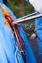 Laparoscopic vasectomy of wild elephant (Loxodonta africana), showing instruments in 'keyhole'. Private game reserve in Limpopo, South Africa, April 2011