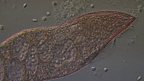 Ciliate protozoan (Blepharisma japonicum) swimming through clumps of bacteria.