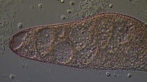 Ciliate protozoan (Blepharisma japonicum) swimming through clumps of bacteria.