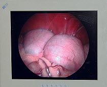 Endoscope image of two foetuses within the uterus of a female Eurasian beaver (Castor fiber) observed while being checked for Tapeworms (Echinococcus multilocularis) by Royal Zoological Society of Sco...