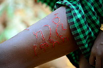 Young woman from the Bodi tribe displaying elaborate skin scarifications on her leg, her name in Amharic language, Omo Valley, Ethiopia, March 2015.