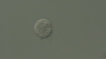 Ciliate Protozoan, a micropscopic organism. Slow motion footage of it moving through sample of freshwater, from River Teifi, Wales, UK. October. Taken with High Magnification Differential Interference...