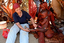 Caucasian woman applying antibiotic ointment to a burned himba child. Burns from the open fires or embers are among the most common injuries, especially in children, Marienfluss Valley, Kaokoland Dese...
