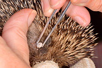 Hedgehog tick (Ixodes hexagonus) removal from a Hedgehog (Erinaceus europaeus) with tweezers, Chippenham, Wiltshire, UK, August 2017. Model released.
