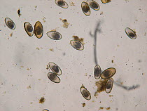 Microscopic image of oxyurid nematode parasites in the faecal sample of a captive Hermann&#39;s tortoise (Testudo hermanni) Small repro only.