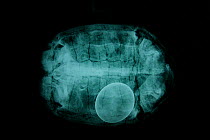Radiography of a Spider tortoise (Pyxis arachnoides) showing a characteristic of this species - they just lay one egg. Captive. Small repro only.