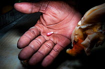 A pearl from a queen conch (Lobatus gigas) in the hand of a conch fisherman on Harbour Island, Bahamas.