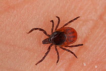 Tick (Ixodida sp) on skin, a vector for Lyme Disease, Q Fever, and Tick-borne Encephalitis. Norway. May.