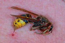 Dead European hornet (Vespa crabro) next to sting mark on human skin, near Tour, Central France.