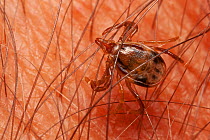 Paralysis tick (Ixodes holocyclus) female on human skin, feeds on mammals, birds and reptiles, highly dangerous to humans, can lead to paralysis and death if not removed, Buyna Pine Mountains National...
