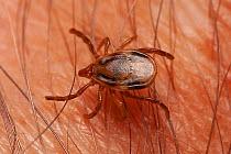 Paralysis tick (Ixodes holocyclus) female on human skin, feeds on mammals, birds and reptiles, highly dangerous to humans, can lead to paralysis and death if not removed, Bunya Pine Mountains National...