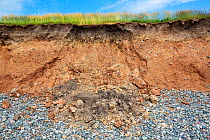 Coastal erosion caused by increased stormy weather and rising sea levels, Walney Island, Cumbria, UK. June, 2021.