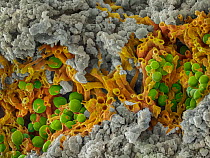 False-coloured scanning electron micrograph of a cleaved sample of a crustose lichen growing on grey limestone, the orange are fungal threads and the green shows algal cells. The fungal threads anchor...