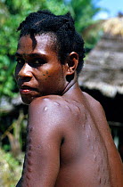 Crocodile Woman, scarification on women is seen as a symbol of beauty. The scars are made by rubbing ash into a wound so it becomes inflamed and heals as a raised scar, Karawari, Papua New Guinea, Oce...